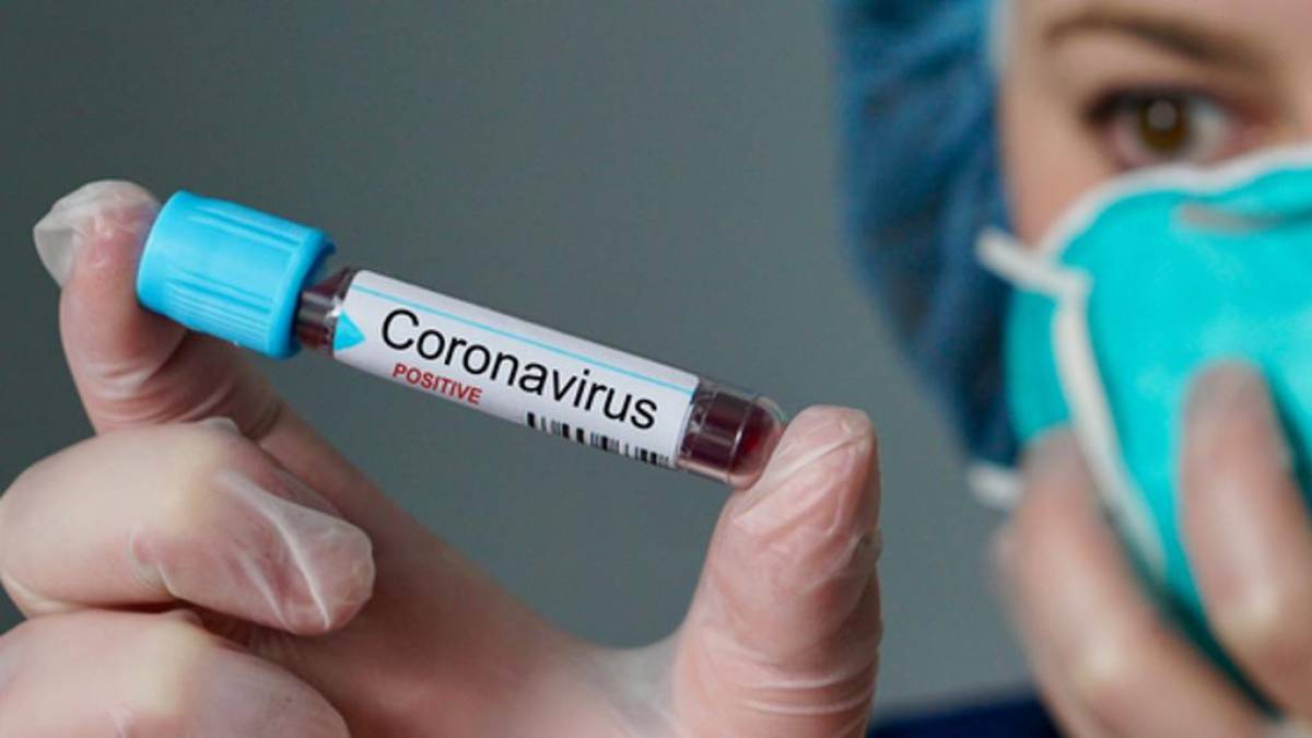 Coronavírus 2.jpg