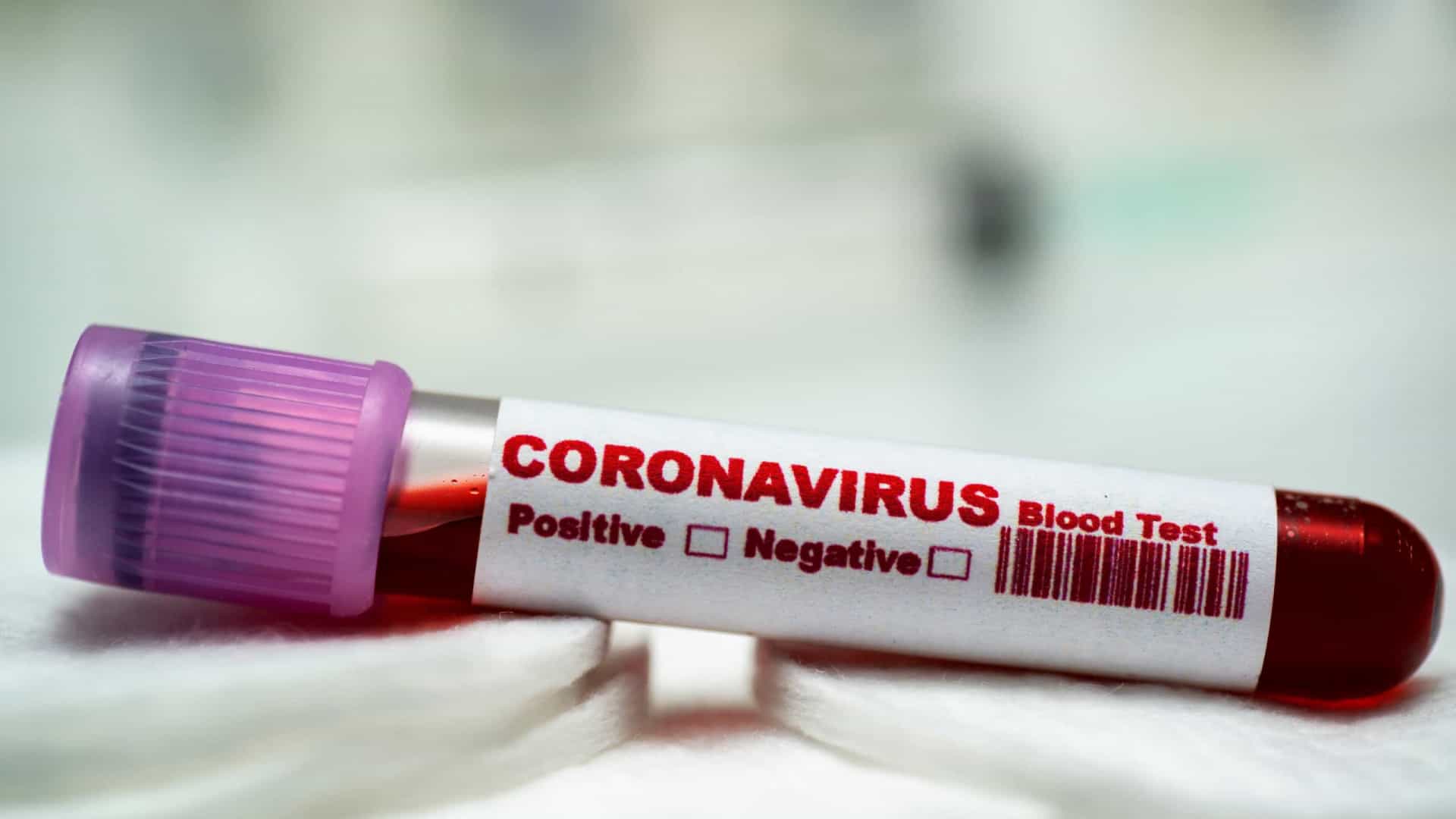 Coronavírus 3.jpg