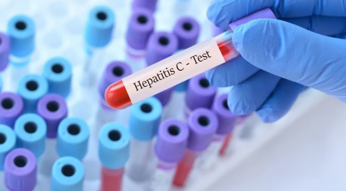 Hepatite C.jpg